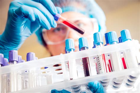Lab Tests .